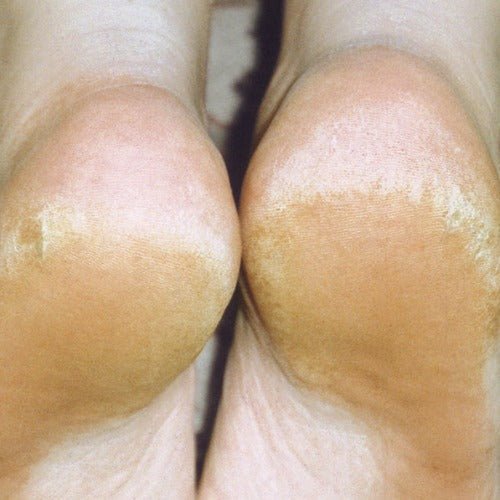 Crack Free Hands & Heels 65gm - 1st Stop Marshall's Health Shop, Gift Shop! - Heath and Natural Therapy New Brighton Christchurch - Naturopath