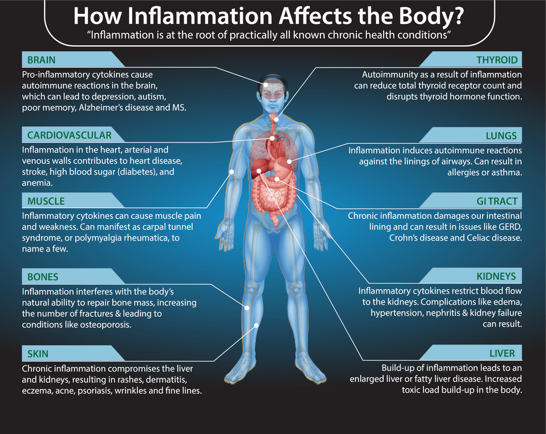 INFLAMMATION | The Good | The Bad | The Answer - MarshallsHealthShop