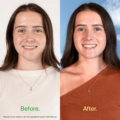 BePure Skin Rescue - MarshallsHealthShop