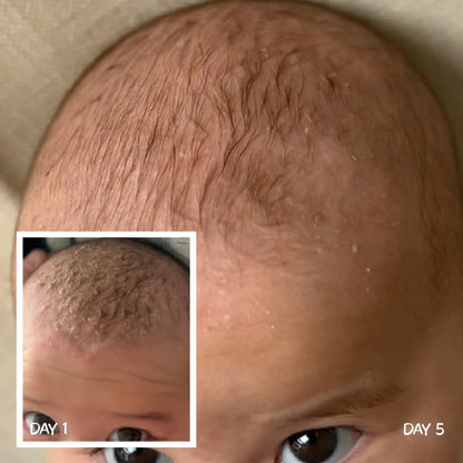 MOOGOO Baby Scalp Repair Cream 120g - 1st Stop Marshall's Health Shop, Gift Shop! - Heath and Natural Therapy New Brighton Christchurch - Naturopath