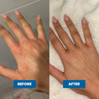 MOOGOO Baby Scalp Repair Cream 120g - 1st Stop Marshall's Health Shop, Gift Shop! - Heath and Natural Therapy New Brighton Christchurch - Naturopath