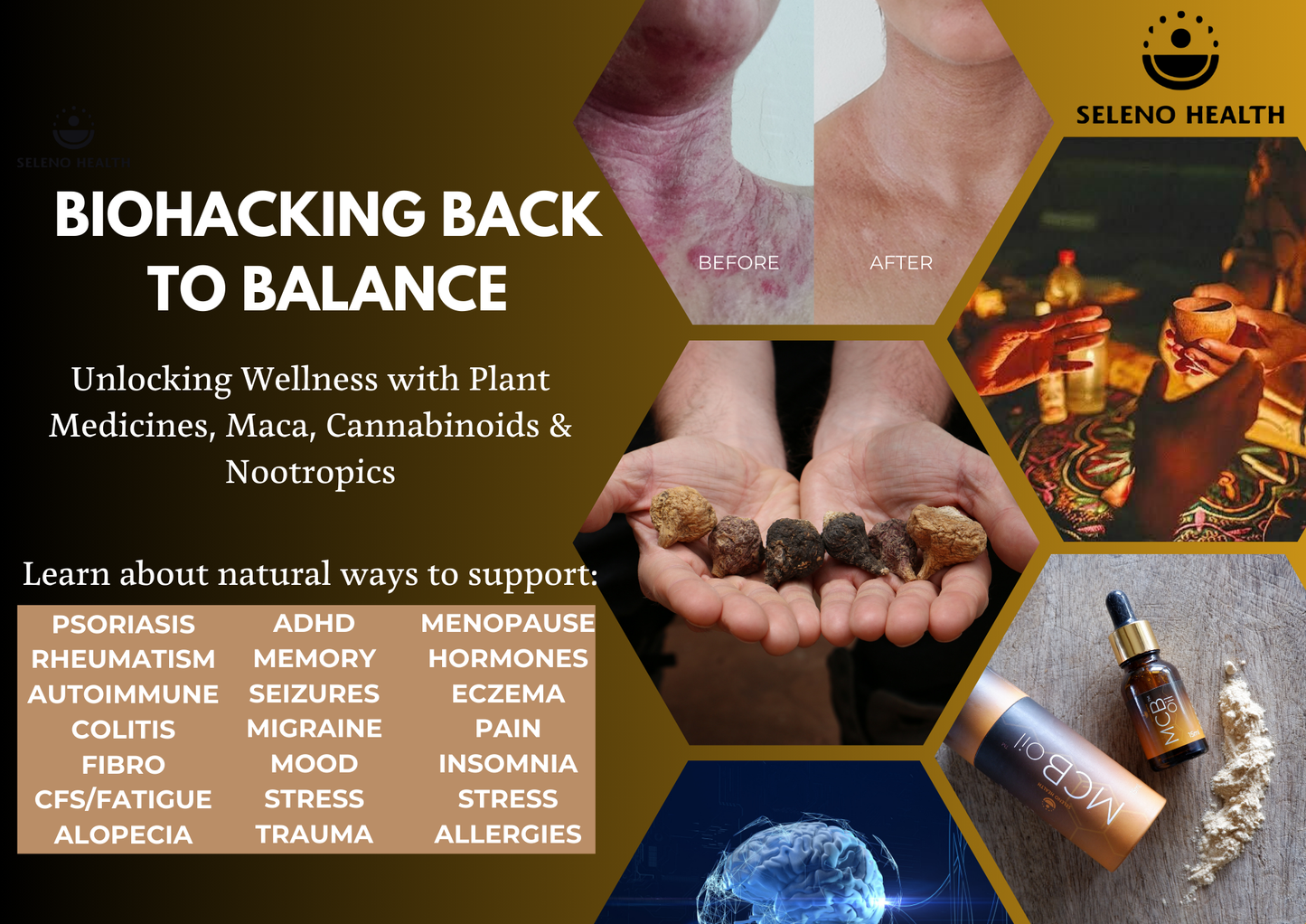 Seleno Health Seminar - Biohacking Back to Balance